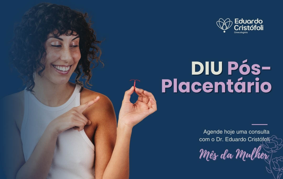 Inserção do DIU pós-placentário com o Dr. Eduardo Cristofoli, ginecologista em Londrina