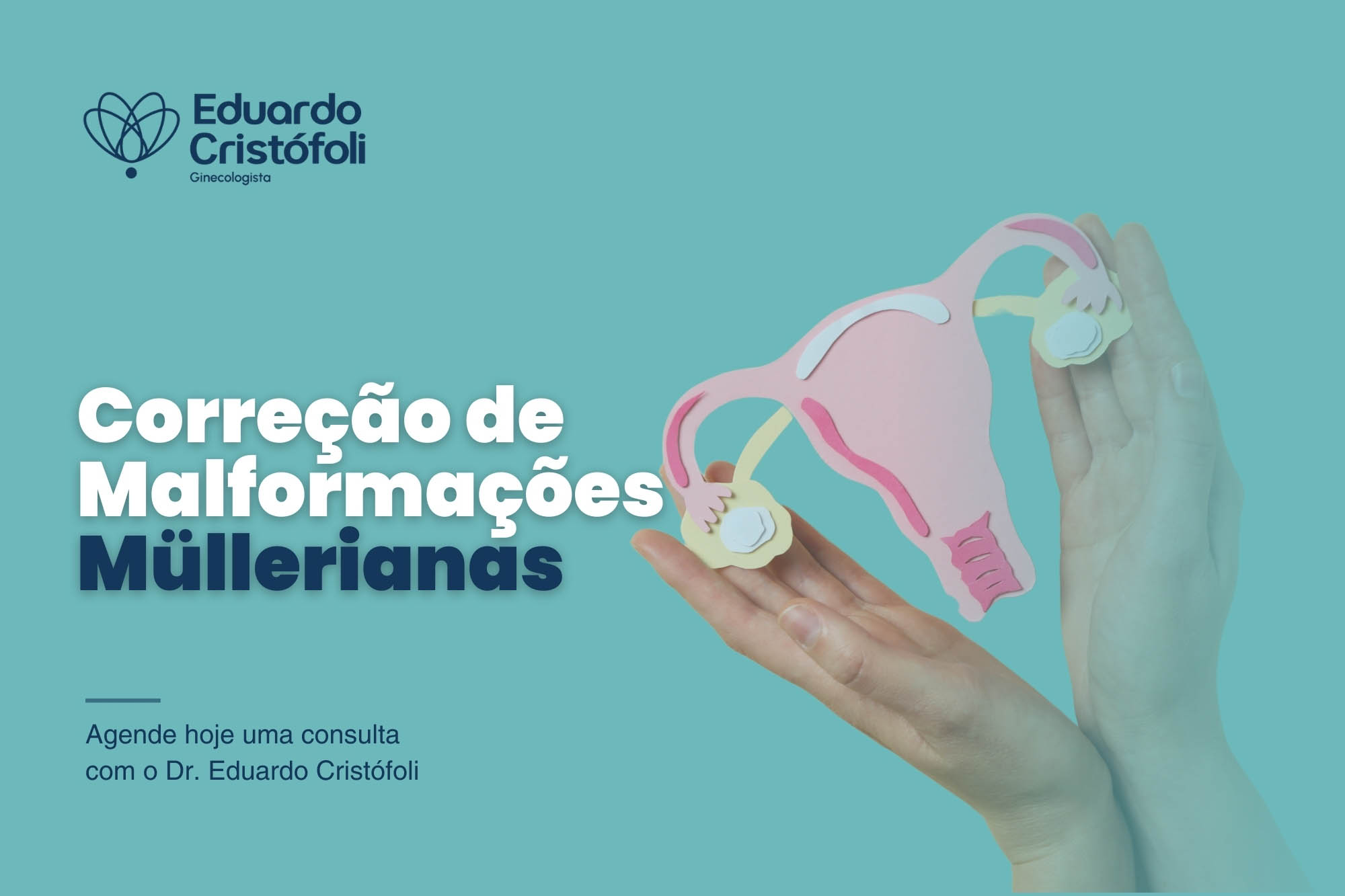 O Dr. Eduardo Cristófoli, ginecologista, oferece tratamento para a correção de malformações müllerianas. Agende sua consulta para saber mais.