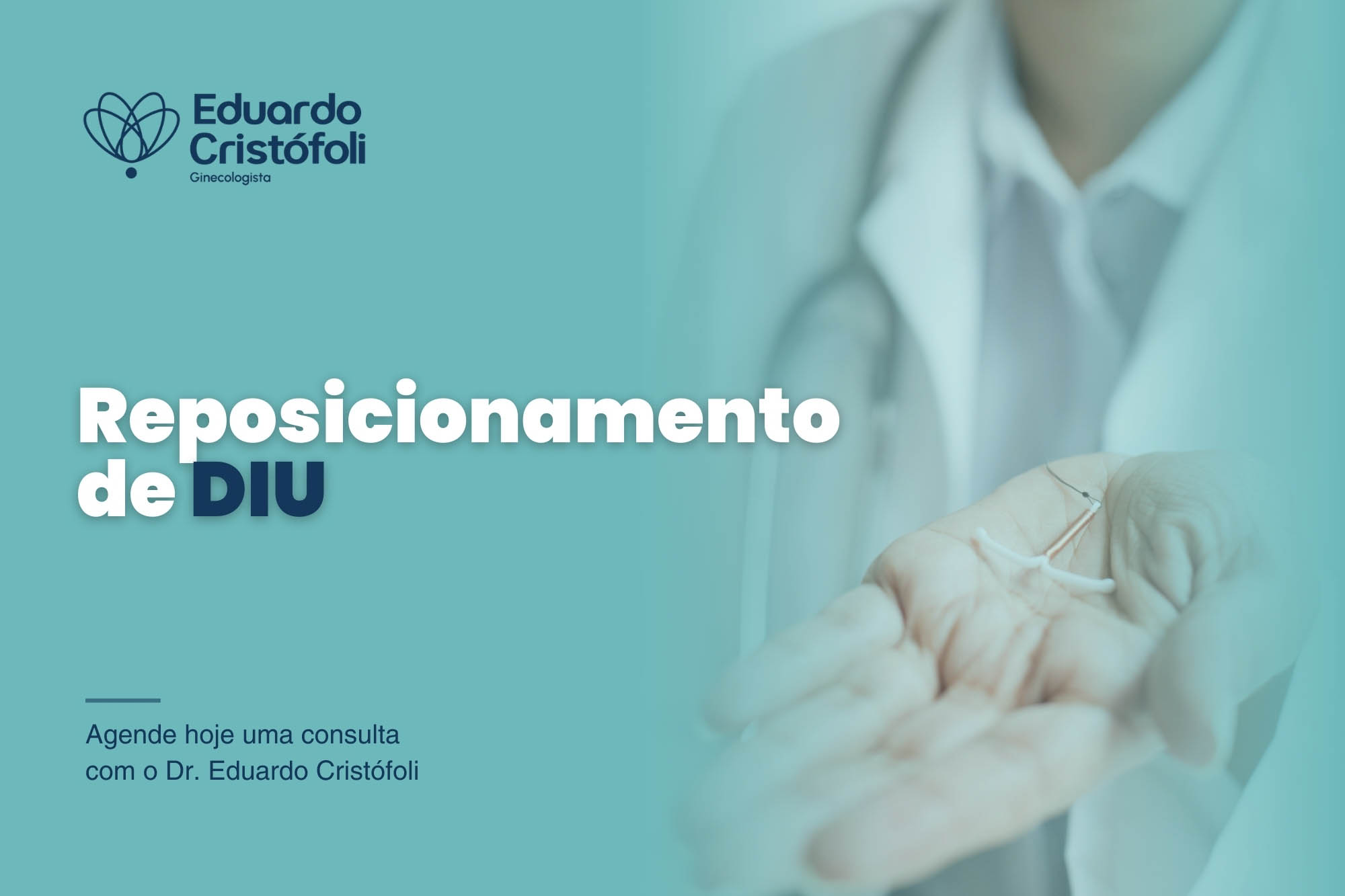 "Reposicionamento de DIU": Mitos e verdades. Entenda a conduta correta com Dr. Eduardo Cristófoli, ginecologista em Londrina. Agende sua avaliação.