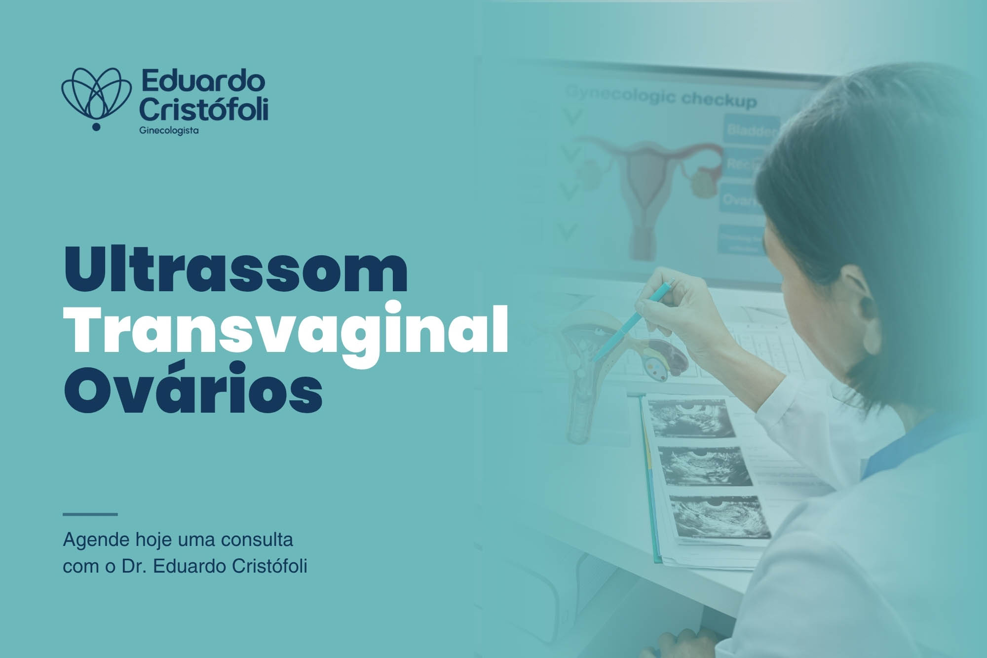 Ultrassom transvaginal ovários: o que você precisa saber para cuidar da saúde íntima