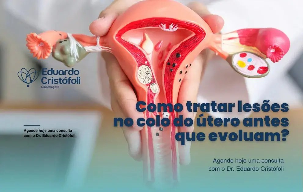 Como tratar lesões no colo do útero antes que evoluam?
