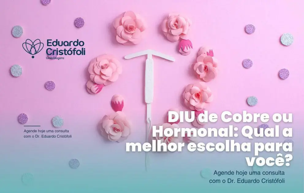 DIU de Cobre ou Hormonal: Qual a melhor escolha para você?