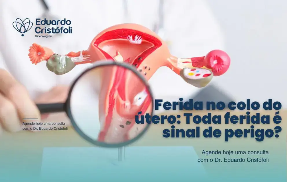 Ferida no colo do útero: Toda ferida é sinal de perigo?