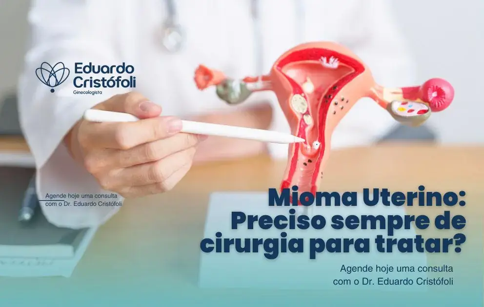Mioma Uterino: Preciso sempre de cirurgia para tratar?