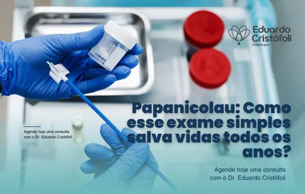 Papanicolau: Como esse exame simples salva vidas todos os anos?