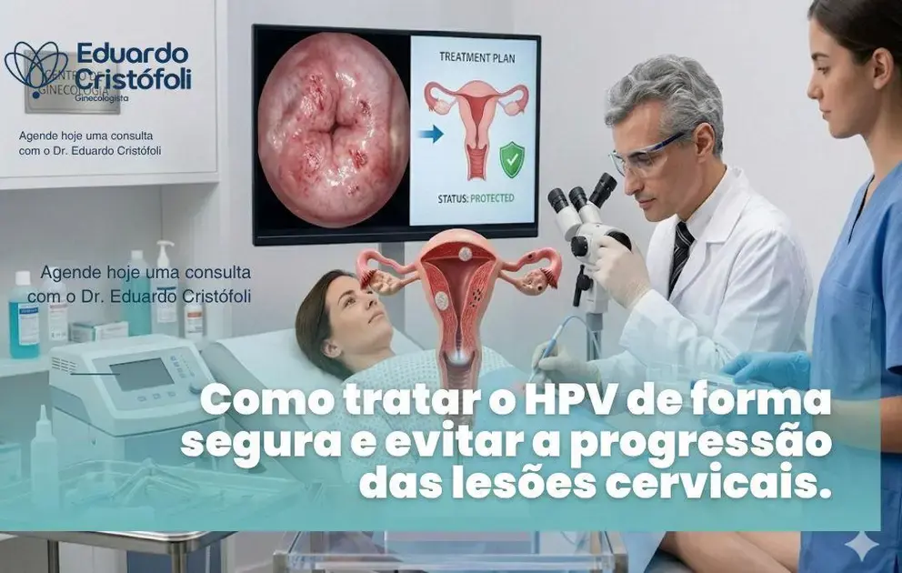 Como tratar o HPV de forma segura e evitar a progressão das lesões cervicais.