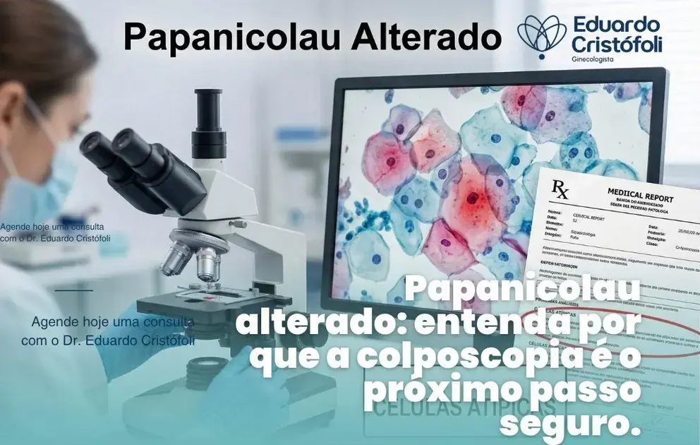 Papanicolau alterado: entenda por que a colposcopia é o próximo passo seguro.
