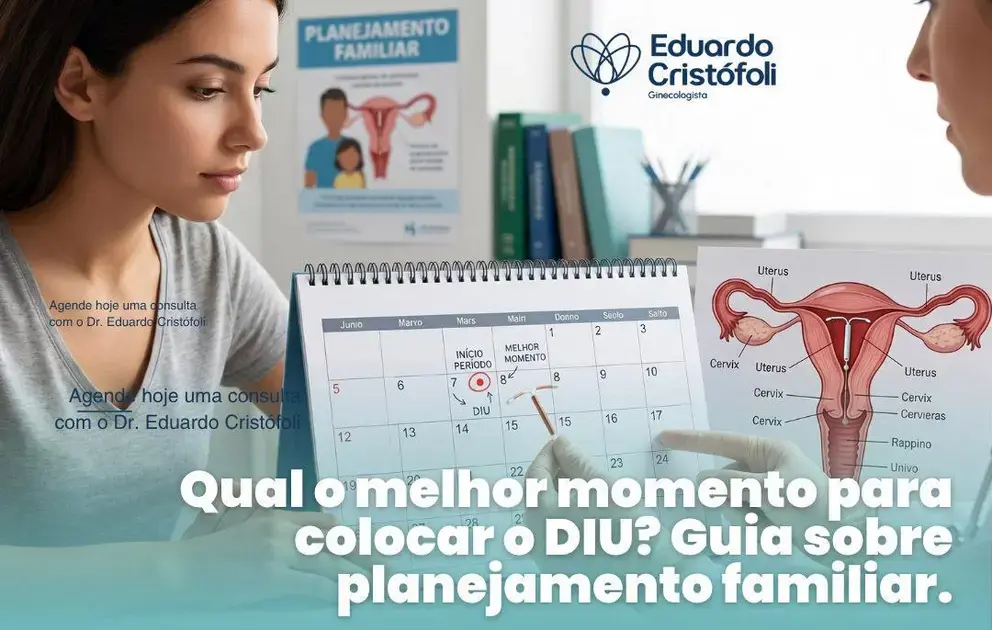 Qual o melhor momento para colocar o DIU? Guia sobre planejamento familiar.