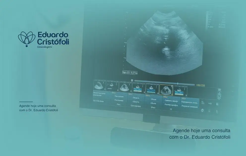 A Importância da Ultrassonografia Ginecológica na Sua Avaliação