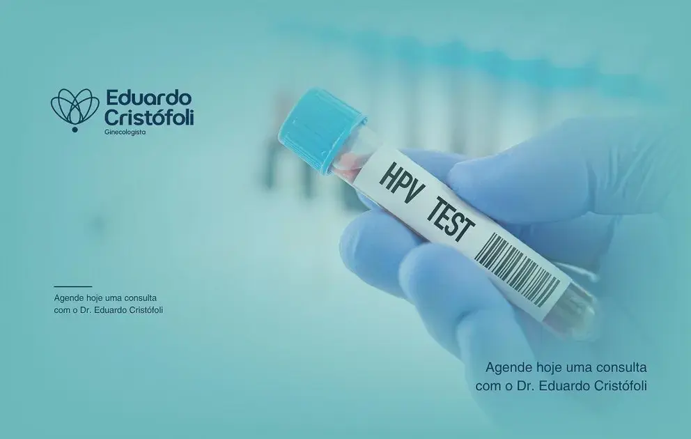 Diagnóstico e Tratamento do HPV: Como Protejo a Sua Saúde