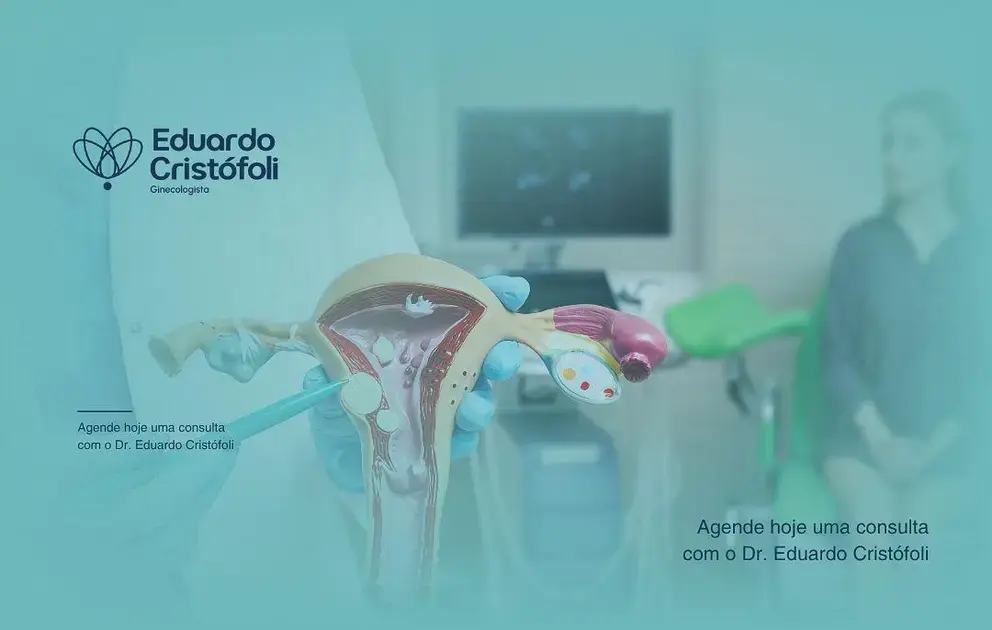 Tratamento de Pólipos Uterinos: Segurança na Histeroscopia Ambulatorial