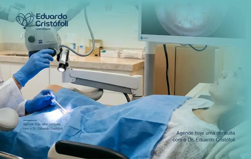 Colposcopia permite avaliar lesões suspeitas com precisão.