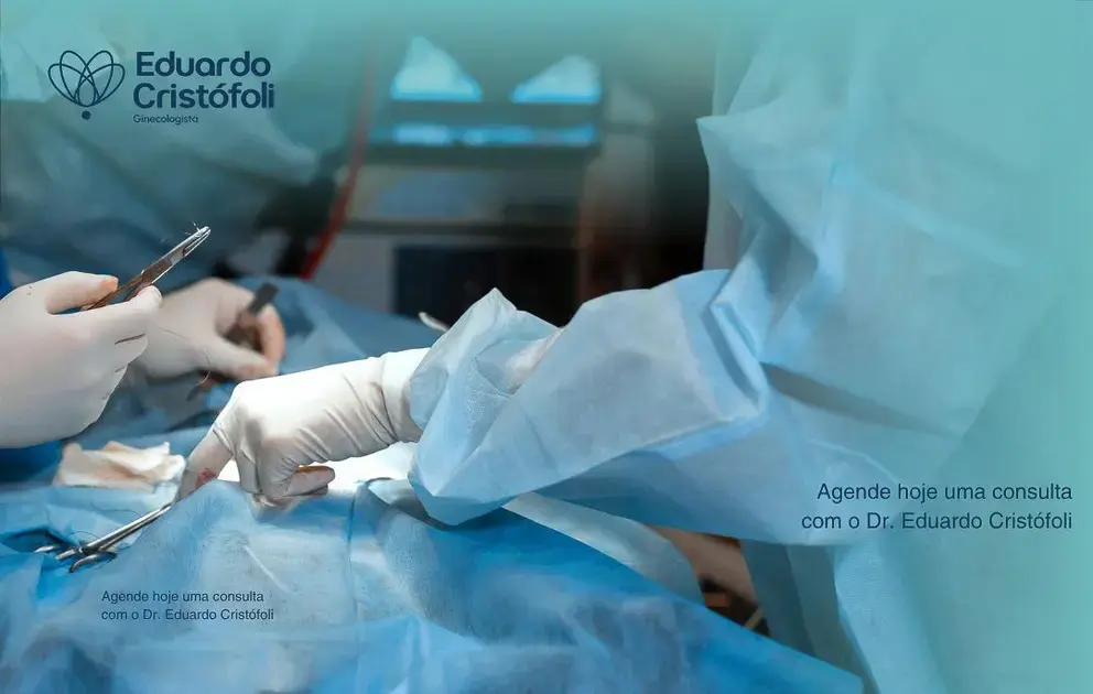 Histeroscopia moderna retira miomas sem cortes externos.