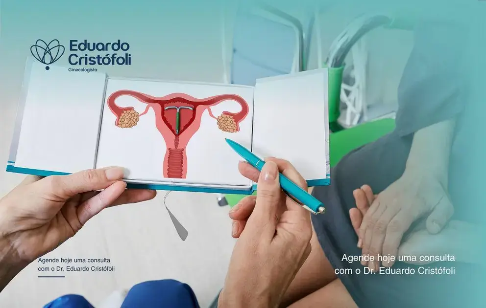 Inserção de diu requer avaliação muito cuidadosa.