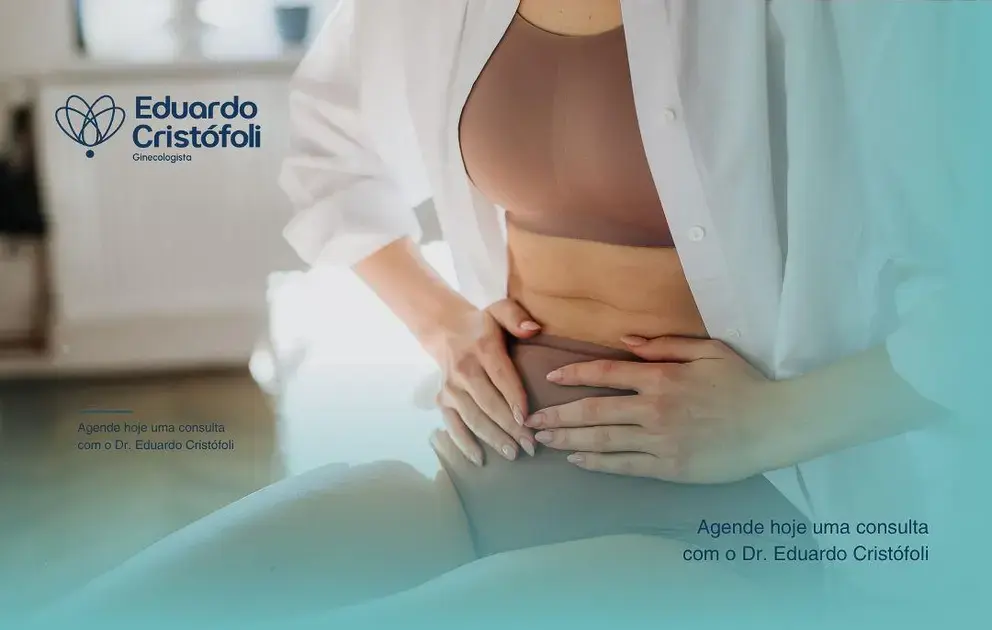 A histeroscopia remove os miomas com precisão.