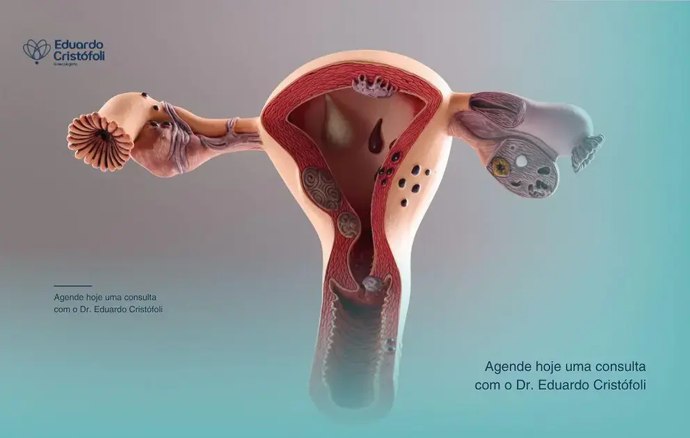 Colposcopia avalia o colo uterino com precisão.