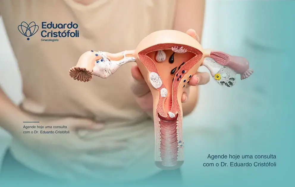 Histeroscopia diagnóstica permite visualizar o seu útero.