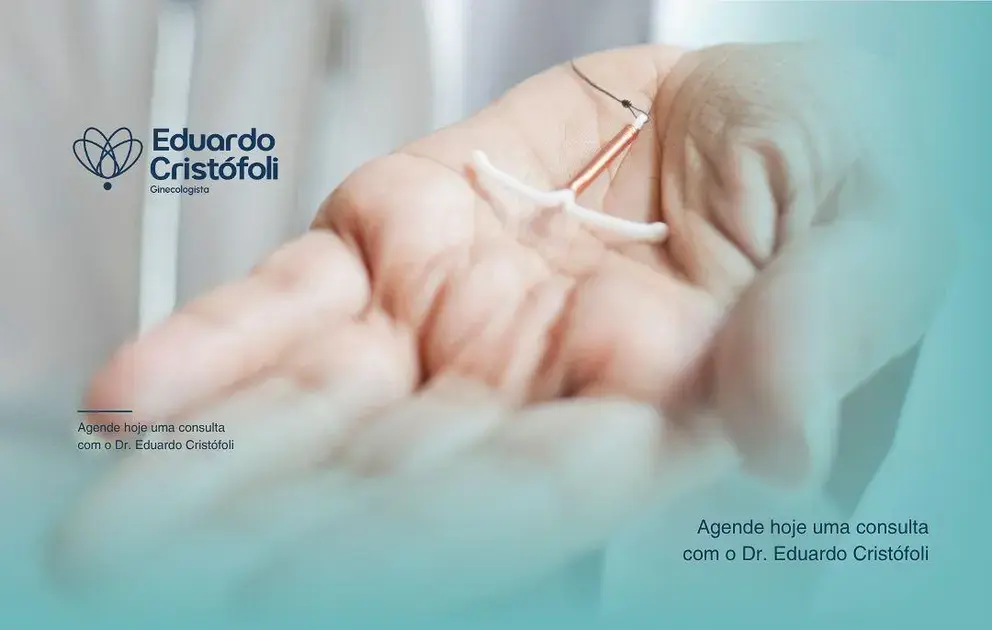 Inserção do dispositivo DIU oferece muita tranquilidade.