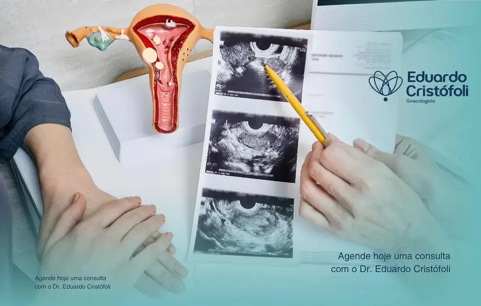 Oncoginecologia e o diagnóstico precoce