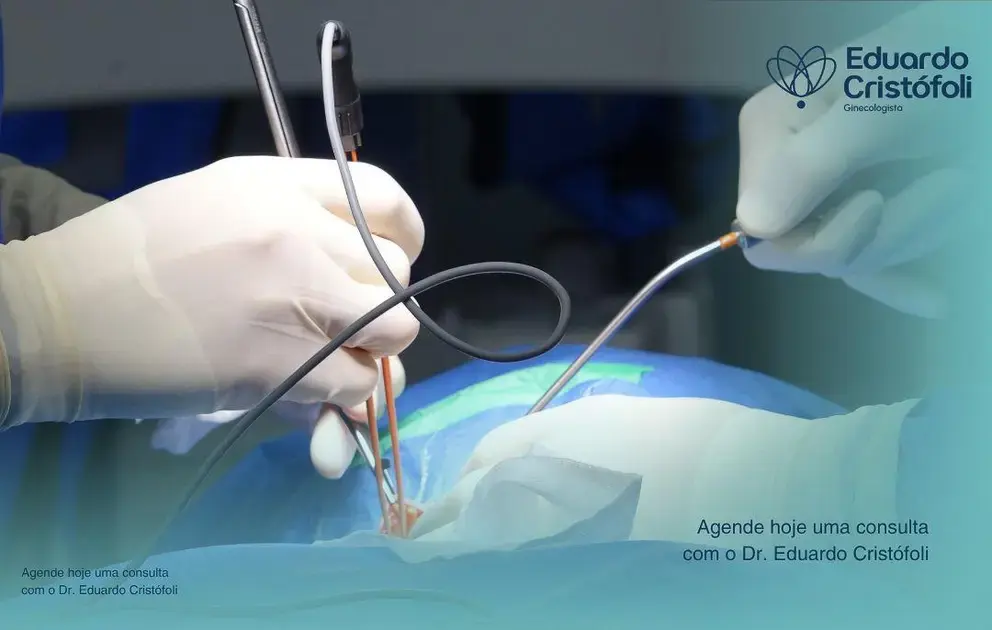 Recuperação rápida com a Histeroscopia Ambulatorial