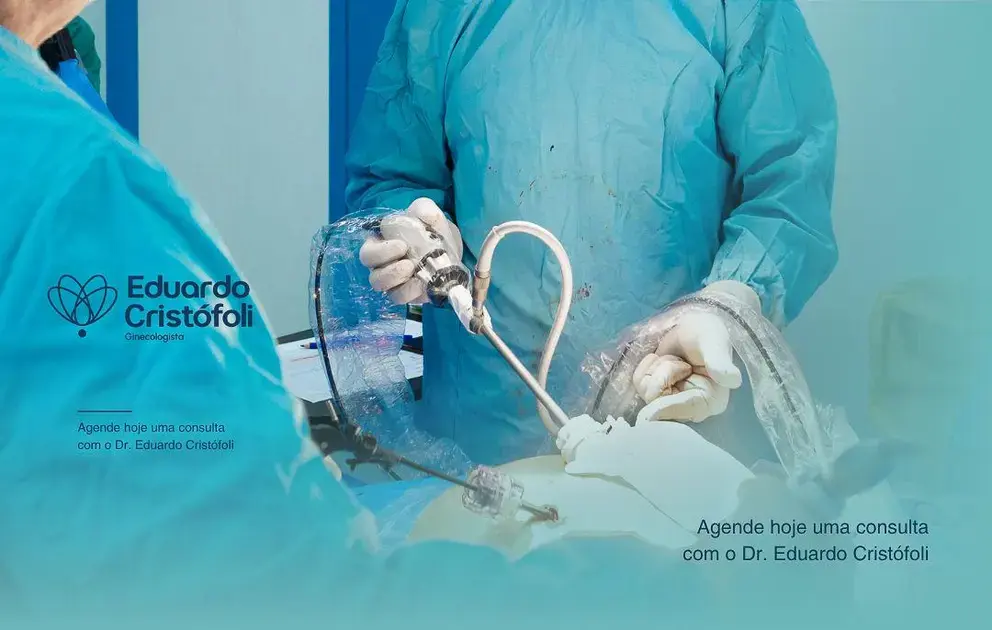 Vantagens da Cirurgia Ginecológica Minimamente Invasiva