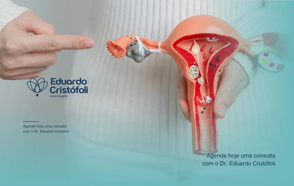Histeroscopia Cirúrgica: Tratamento Minimamente Invasivo