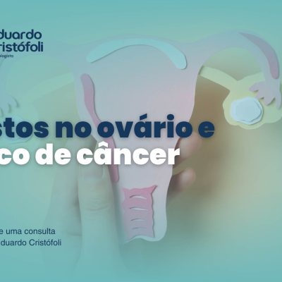 Cistos no ovário e risco de câncer: quando a atenção faz toda a diferença