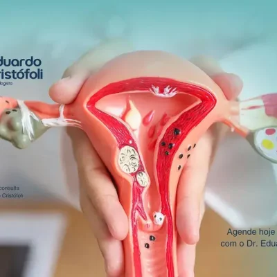 Colposcopia e a prevenção do câncer