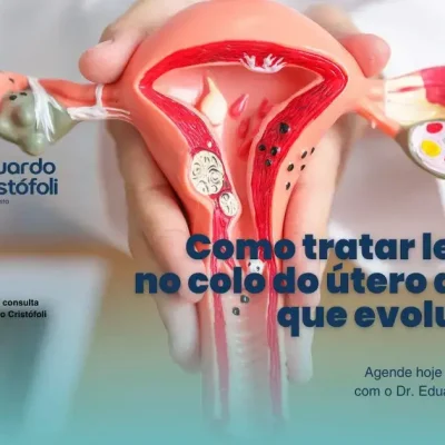 Como tratar lesões no colo do útero antes que evoluam?