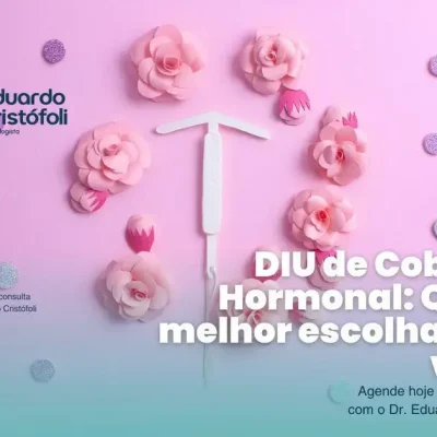 DIU de Cobre ou Hormonal: Qual a melhor escolha para você?