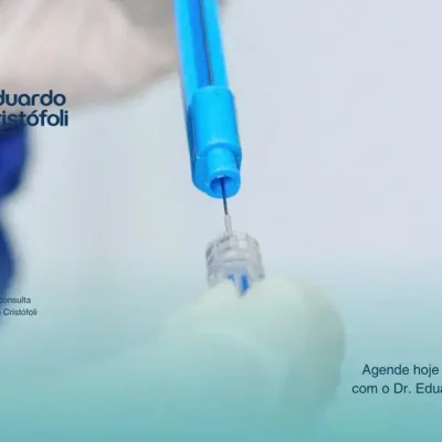 Entenda a diferença entre histeroscopia diagnóstica e histeroscopia cirúrgica.