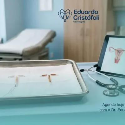 Escolhendo o Melhor DIU para o seu Perfil
