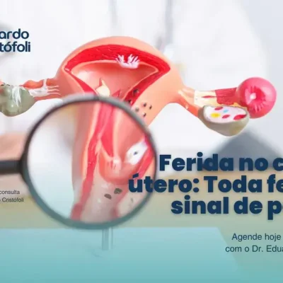 Ferida no colo do útero: Toda ferida é sinal de perigo?