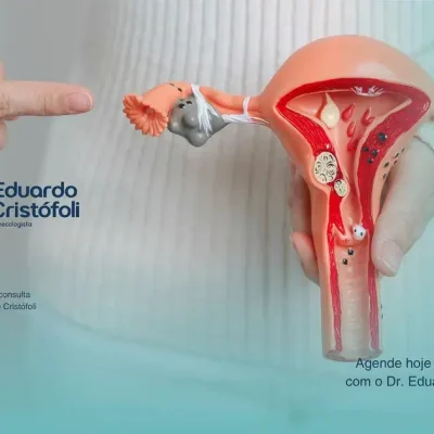 Histeroscopia Cirúrgica: Tratamento Minimamente Invasivo