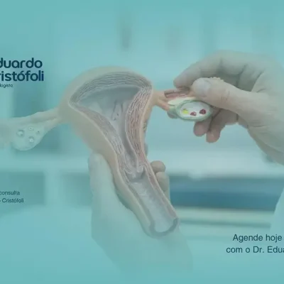 Lesões no Colo Uterino: Como Conduzo o Seu Tratamento