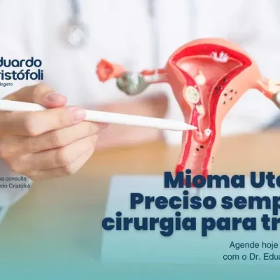 Mioma Uterino: Preciso sempre de cirurgia para tratar?