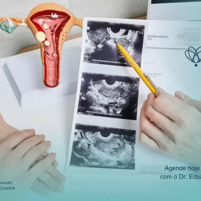 Oncoginecologia e o diagnóstico precoce