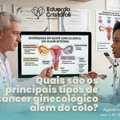 Quais são os principais tipos de câncer ginecológico além do colo?