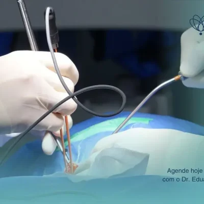 Recuperação rápida com a Histeroscopia Ambulatorial