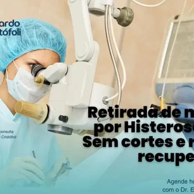 Retirada de mioma por Histeroscopia: Sem cortes e rápida recuperação
