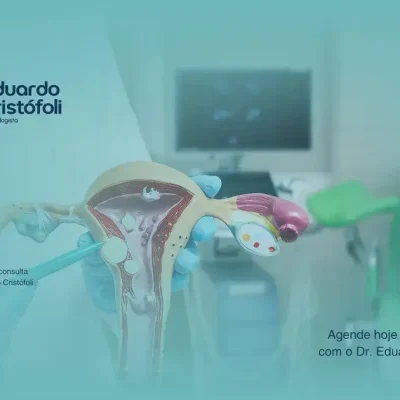 Tratamento de Pólipos Uterinos: Segurança na Histeroscopia Ambulatorial